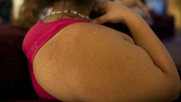 Un enfant belge sur cinq est trop gros