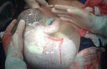 123 Le bébé dans sa poche d'eau, la photo insolite qui fait le tour du web